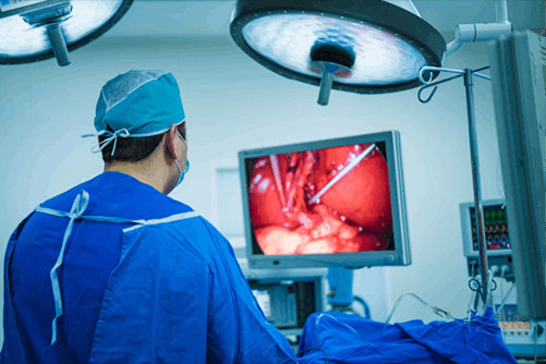 minimally invasive surgery